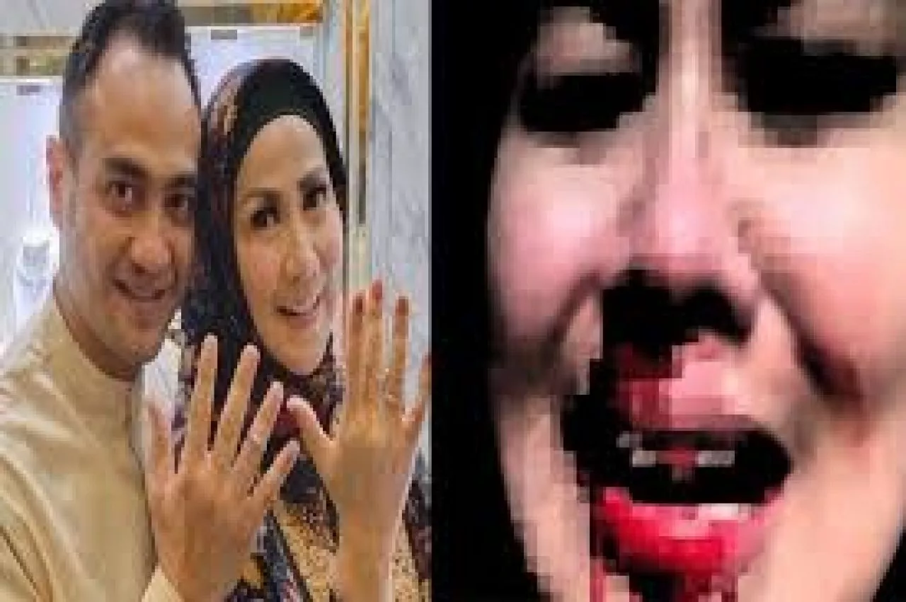 Polda Jatim : Ferry Irawan resmi menjadi tersangka dugaan KDRT